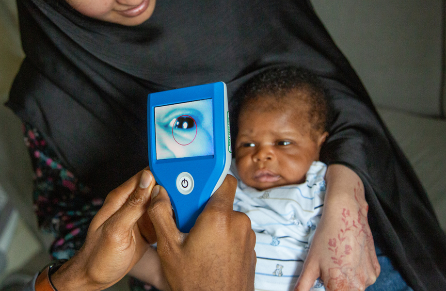 Picture shows Neocam device being used to screen a baby's eyes for possible cataracts.