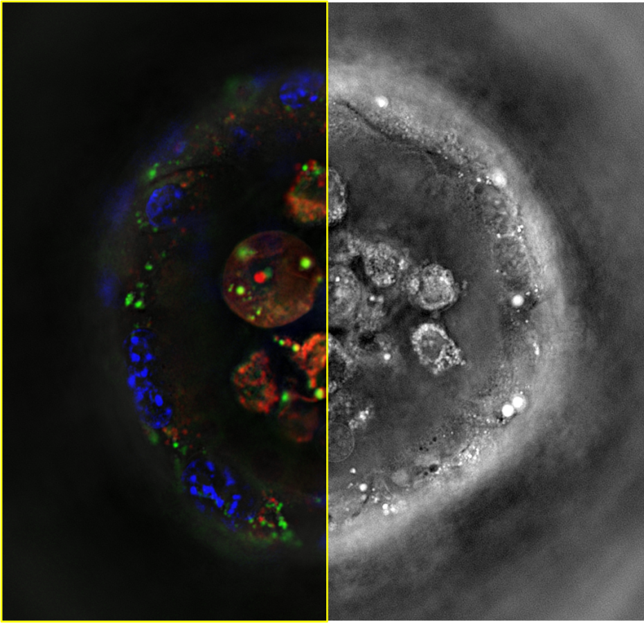 Spheroid confocal spinning disk (left) and holotomography acquisitions (right).