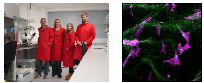 The Cyclana Bio team	In vitro 3D model showing ECM components (green) and cells (magenta)