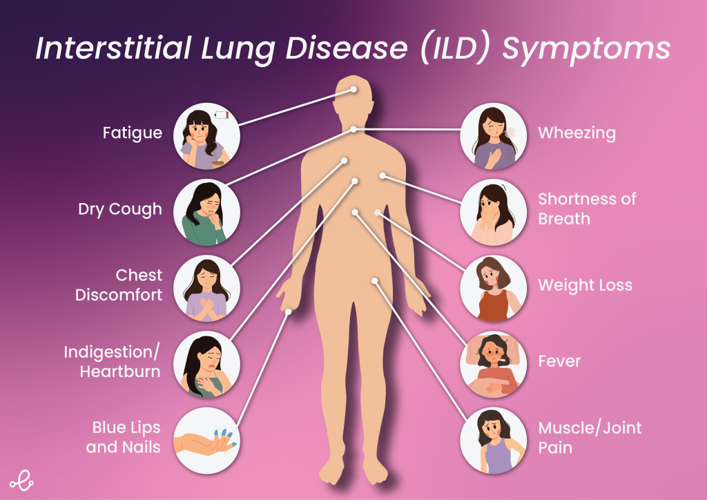 ILD symptons