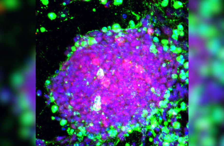 Immunofluorescence image of induced pluripotent cells (iPS) in culture