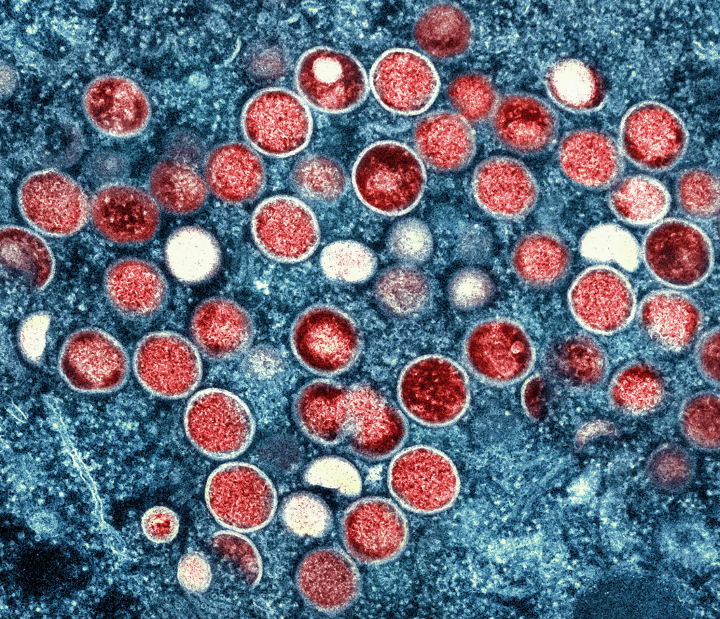 Transmission Electron microscopic image of Mpox virus particles Credit: CDC/ National Institute of Allergy and Infectious Diseases (NIAID)