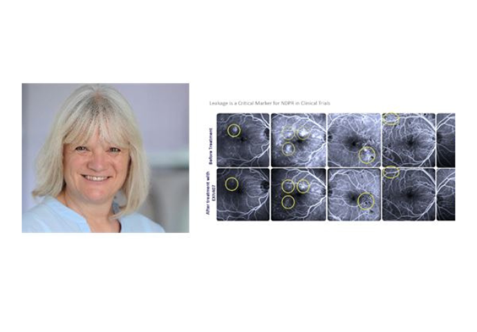 Dr Catherine Beech, CEO, Exonate	Imaging from Phase IIa study demonstrates significant reduction in vascular leakage, a critical marker for NDPR