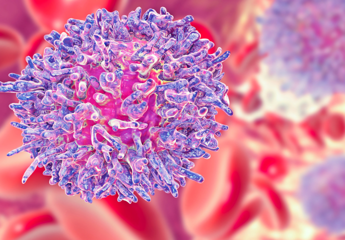 Hairy cell leukaemia