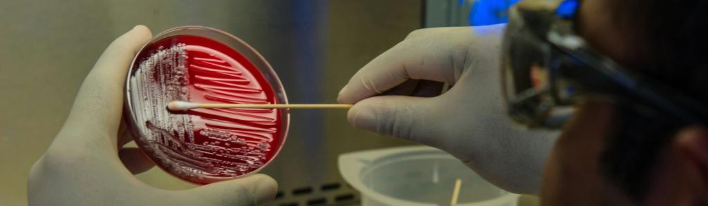 Hospital bug jumps from lungs to gut, raising sepsis risk 