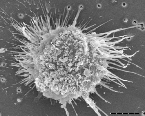 A dendritic cell. Image courtesy of the University of Edinburgh