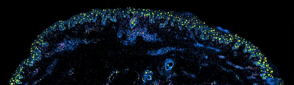 fibroblast single cell 