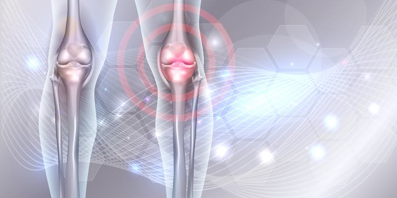 graphic of joints one with red circles indicating arthritis