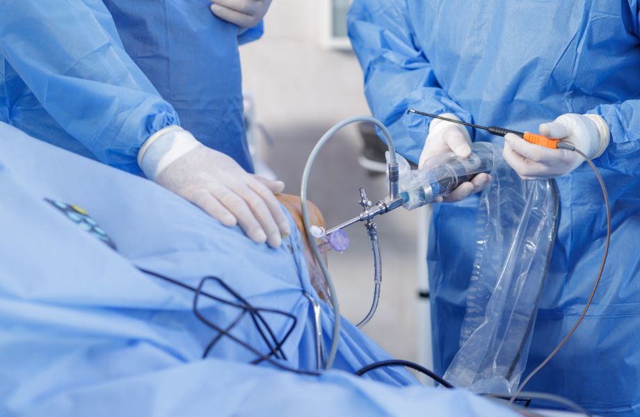 Arthroscopy surgery 