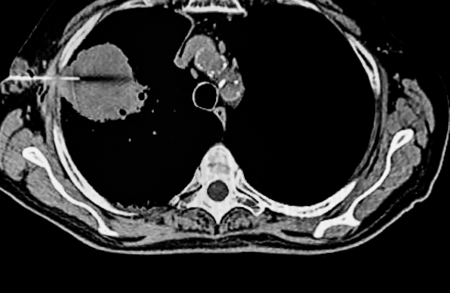 Scan results