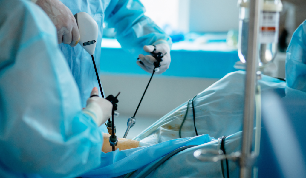 Photo showing surgeon performing laparoscopic surgery with laparoscopic equipment