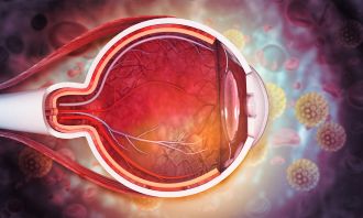 Gene therapies and Wet AMD
