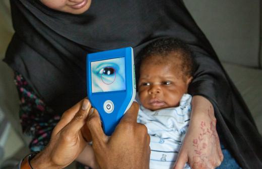 Picture shows Neocam device being used to screen a baby's eyes for possible cataracts.