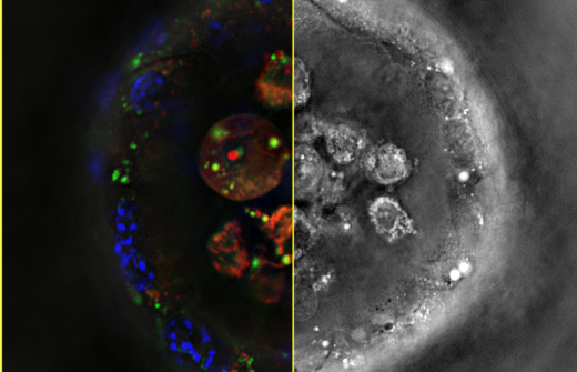 Spheroid confocal spinning disk (left) and holotomography acquisitions (right).