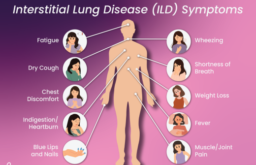 ILD symptons