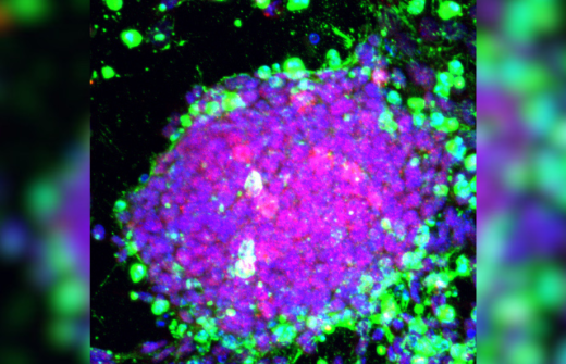 Immunofluorescence image of induced pluripotent cells (iPS) in culture