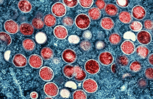 Transmission Electron microscopic image of Mpox virus particles Credit: CDC/ National Institute of Allergy and Infectious Diseases (NIAID)