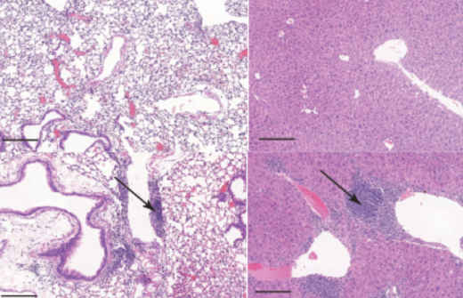 Representative images of sections of the lung (left) and liver (right) from control (upper panel) and knockout mice (lower panel). The arrows indicate accumulation of immune cells into these tissues.