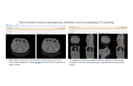 AiSentia CT Scanning