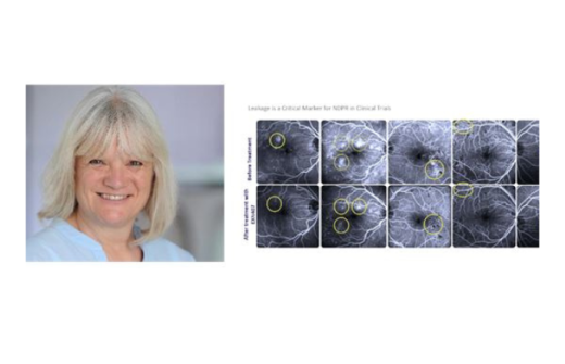 Dr Catherine Beech, CEO, Exonate	Imaging from Phase IIa study demonstrates significant reduction in vascular leakage, a critical marker for NDPR