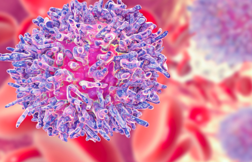 Hairy cell leukaemia