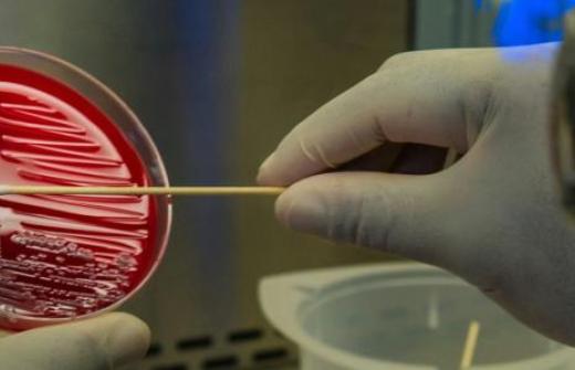 Hospital bug jumps from lungs to gut, raising sepsis risk 