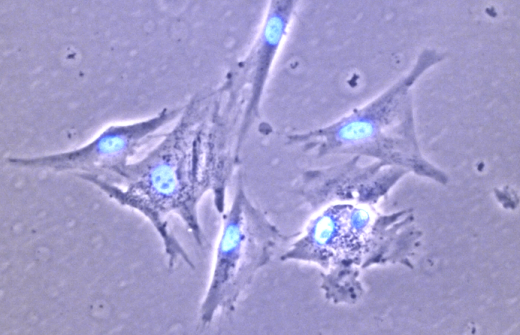 Image of cells as seen by microscope