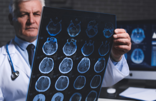 Tackling Alzheimer's Through Respiratory Insights