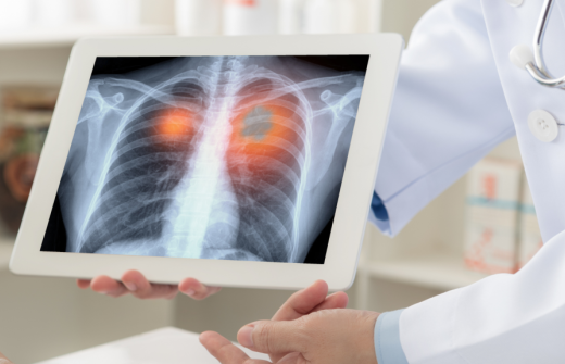 Respiratory Care Digital Innovation Opportunities 