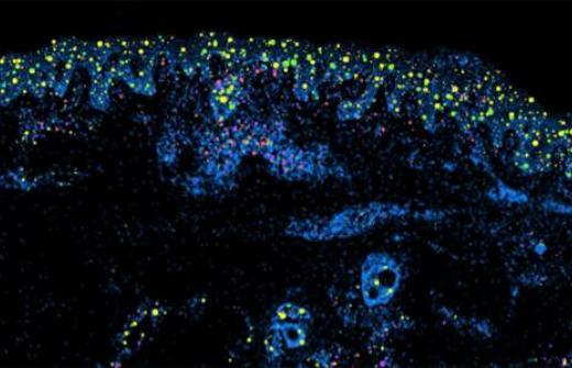 fibroblast single cell 
