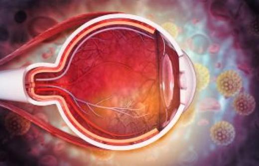 Gene therapies and Wet AMD