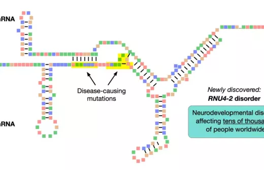 Schematic showing the structures of U4 and U6 RNAs, and the interactions between them. Mutations in the highlighted regions of U4 cause a neurodevelopmental disorder that affects tens of thousands. Image credit: Lab of Ernest Turro, PhD, at Icahn Mount Sinai.