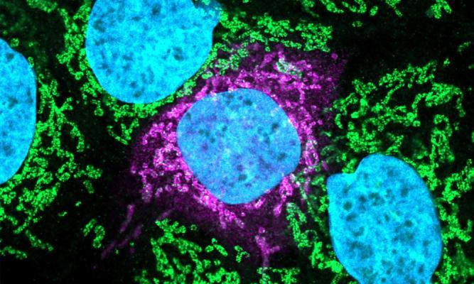 Image:  Human and coronavirus protein interaction. Green, Tom70. Pink, Orf9b. Blue, DAPI. Image credit: Svenja Ulferts, University of Freiburg. Editing credit: Spencer Phillips, EMBL-EBI.