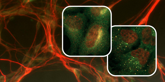 The background image shows induced pluripotent stem cell-derived neuronal cells stained with neuronal antibodies (red). The two panels show cells from an immortalised human cell line (HEK293) growing in control conditions (left) or induced for autophagy (right). Staining is for autophagy proteins.