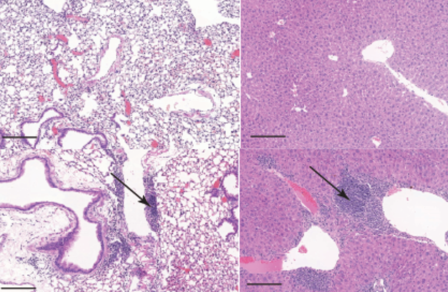 Representative images of sections of the lung (left) and liver (right) from control (upper panel) and knockout mice (lower panel). The arrows indicate accumulation of immune cells into these tissues.