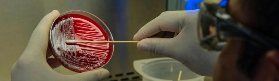 Hospital bug jumps from lungs to gut, raising sepsis risk 