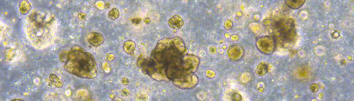 clorectal organoids © Wellcome Sanger Institute