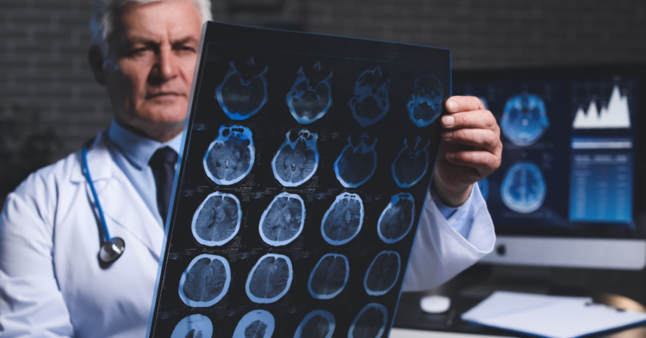 Tackling Alzheimer's Through Respiratory Insights