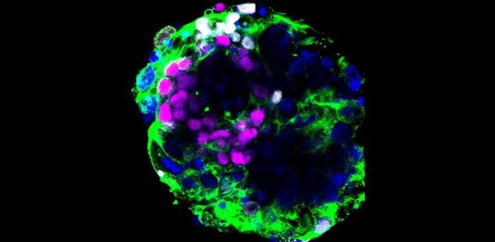   human embryo cultured in vitro  Credit: Zernicka-Goetz Lab