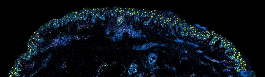 fibroblast single cell 