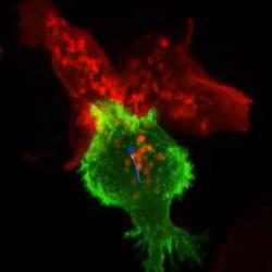 killer T cells Reproduced courtesy of the University of Cambridge