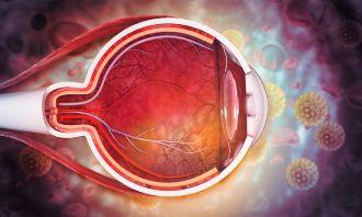 Gene therapies and Wet AMD