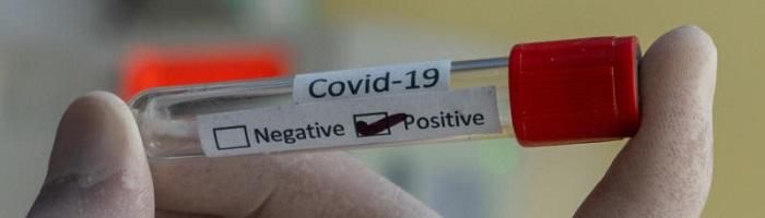 Covid-19 testing vial in a gloved hand.Image credit: Prasesh Shiwakoti Lomash, Unsplash.com 