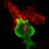 killer T cells Reproduced courtesy of the University of Cambridge